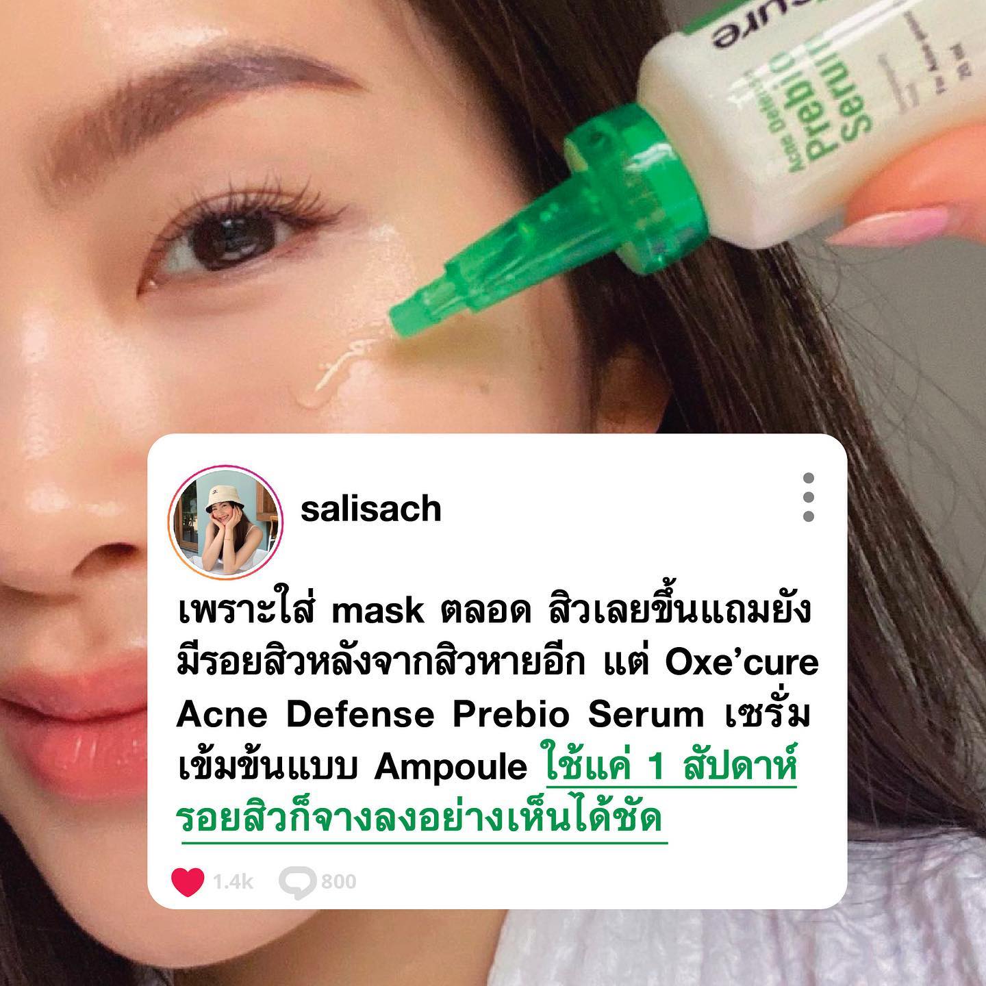  รีวิว พรีไบโอเซรั่ม Oxe'cure